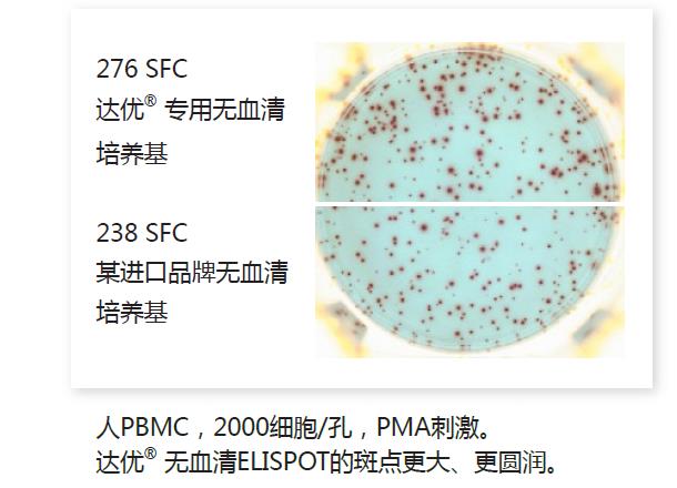 人淋巴細(xì)胞無(wú)血清培養(yǎng)基-斑點(diǎn)2.jpg 人淋巴細(xì)胞無(wú)血清培養(yǎng)基-斑點(diǎn)2.jpg